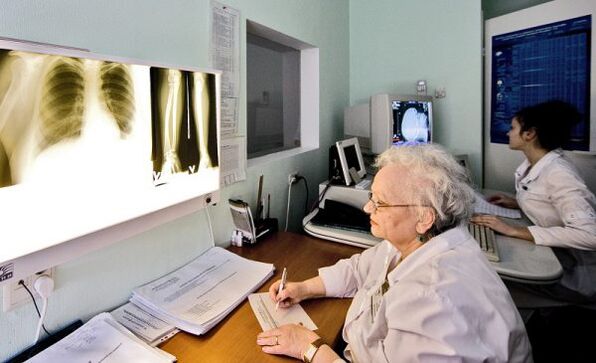 Zdjęcia rentgenowskie do diagnozowania bólu pleców
