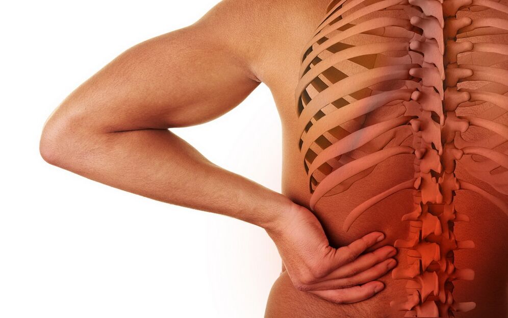 ból pleców z powodu osteochondrozy